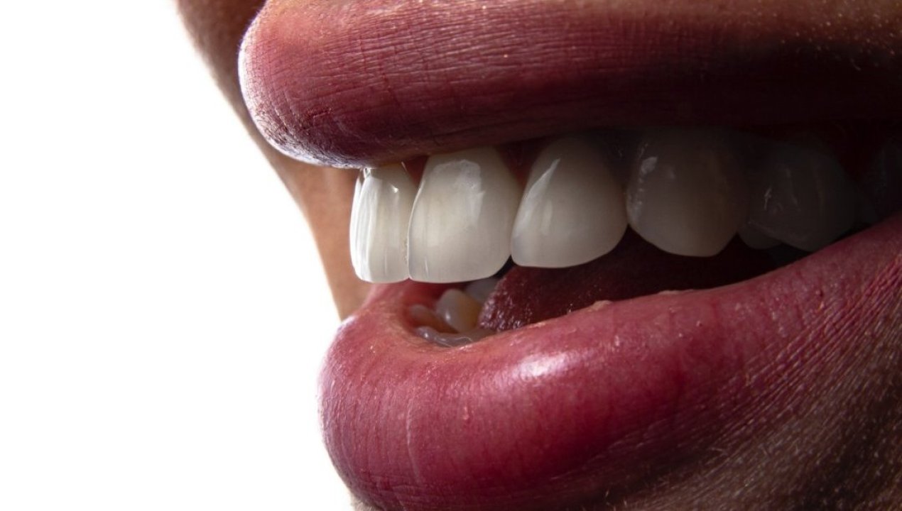 /vodcast/por-que-elegir-implantes-dentales-ventajas-proceso-y-cuidados-para