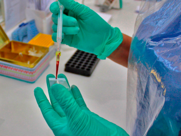 Hanta virus: Informan estado del primer caso del año en el Biobío